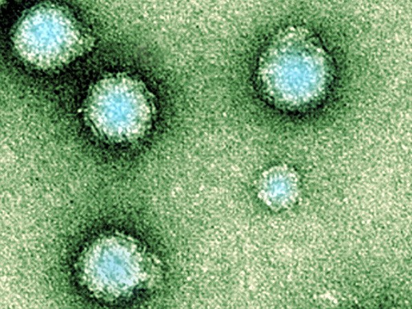 Samoa: Gần 100 người dân mắc bệnh từ một loại virus lạ