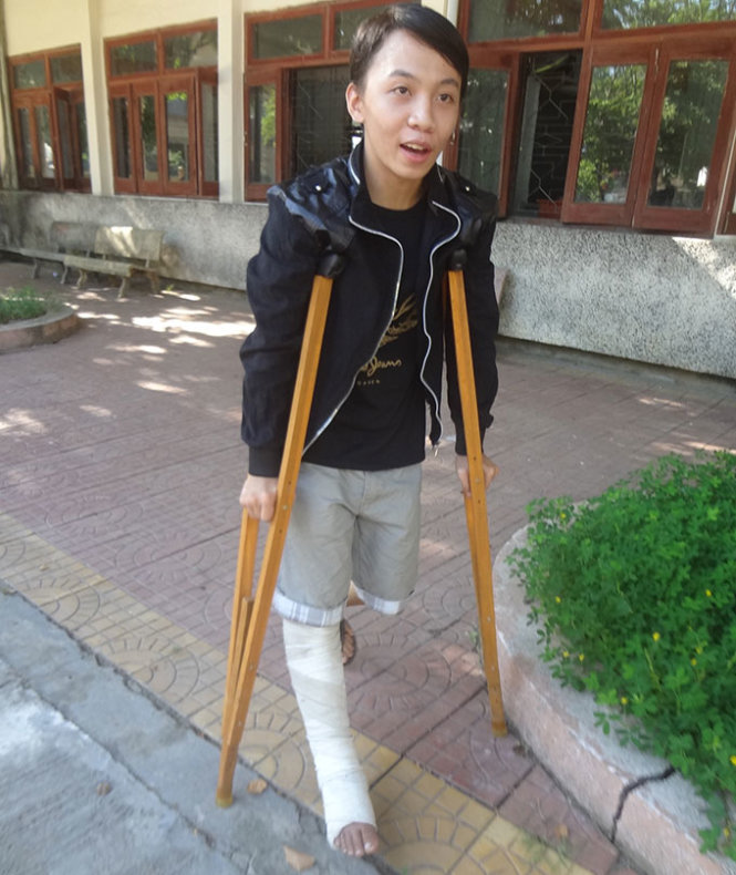 Nhật bị tai nạn giao thông gãy chân phải bó bột - Ảnh: Võ Minh