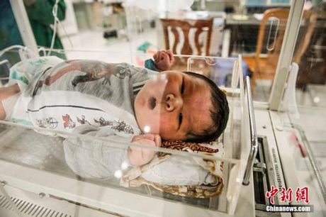 Em bé có cân nặng gấp đôi những đứa trẻ sơ sinh bình thường khác.