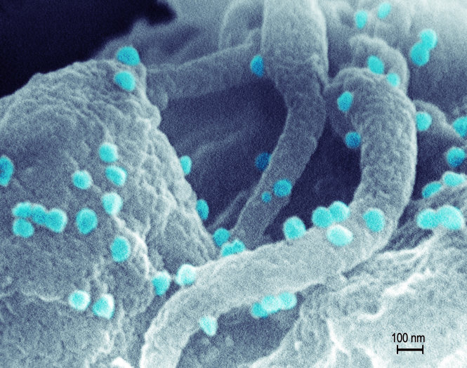 Lôi virút HIV ra khỏi nơi ẩn náu và tiêu diệt chúng là một nghiên cứu mới đầy hứa hẹn-Getty Images