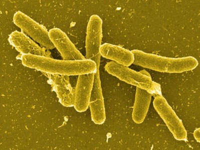 Mỹ điều tra đợt bùng phát các ca nhiễm khuẩn Salmonella Newport