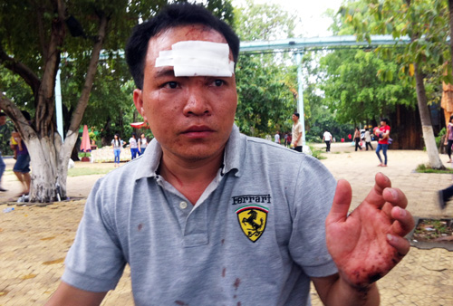 Anh Thời bị kẻ cướp cầm vật nhọn đ&acirc;m bị thương ở tr&aacute;n. Ảnh: An Nhơn