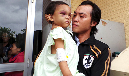 Bé gái 4 tuổi bị bạo hành đã được xuất viện và anh Tố tạm thời được giao quyền chăm sóc bé Ngân