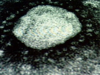 Virus gây bệnh SARS nhìn dưới kính hiển vi 