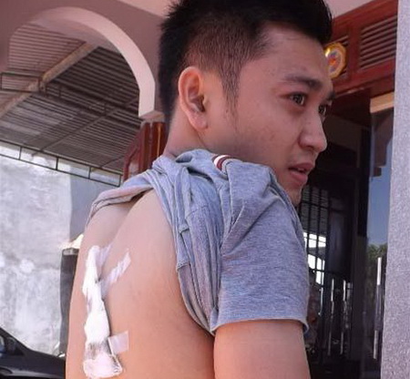 Nữ sinh 12 bị người y&ecirc;u cũ "bắt c&oacute;c", bỏ thi tốt nghiệp