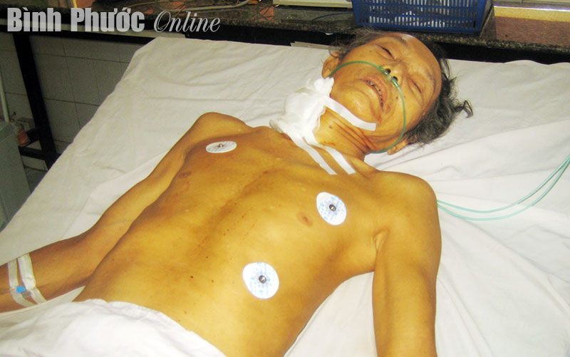 Bị con trai cắt cổ l&uacute;c nửa đ&ecirc;m