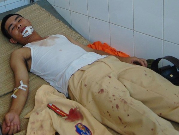 Dũng cảm cứu người, thiếu &uacute;y Cảnh s&aacute;t giao th&ocirc;ng bị c&ocirc;n đồ ch&eacute;m