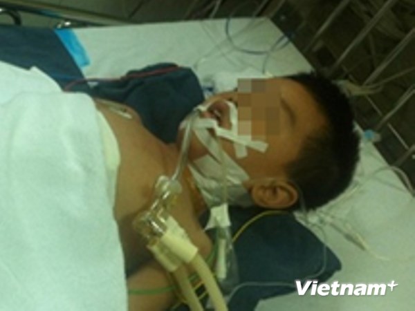 Cứu sống một b&eacute; trai 6 tuổi nguy kịch v&igrave; bị vỡ l&aacute; l&aacute;ch