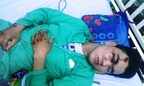 L&agrave;m r&otilde; vụ người đi đường tố bị cảnh s&aacute;t đ&aacute;nh