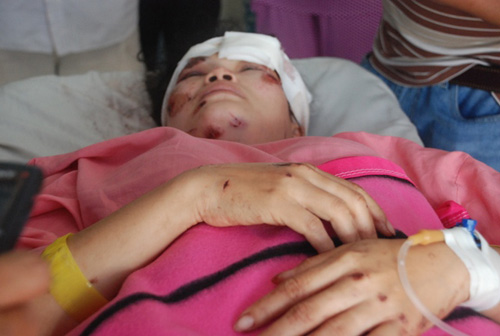 Nổ kinh hoàng ở Sài Gòn: Nạn nhân bàng hoàng kể lại sự việc