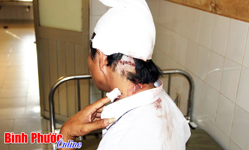 &ldquo;Thượng đế&rdquo; ch&eacute;m t&agrave;i xế l&aacute;i taxi