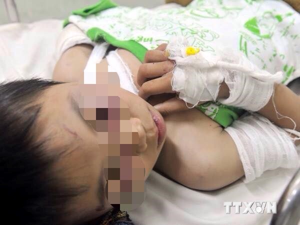 Bé trai bị cha dượng bạo hành đang trong tình trạng nguy hiểm