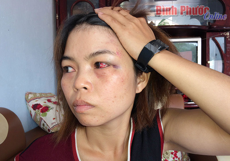 Bị h&agrave;ng x&oacute;m v&agrave;o tận ph&ograve;ng ngủ đ&aacute;nh