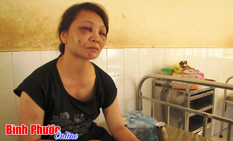 Bị chồng đánh phải nhập viện