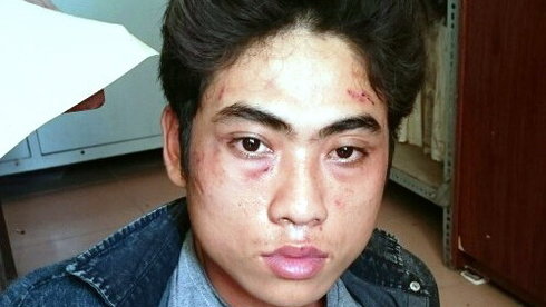 Thua tr&ograve; chơi bắn c&aacute;, cứa cổ chủ tiệm n&eacute;t cướp tiền