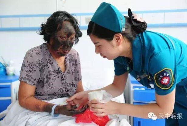 Cháy đen như than vì ăn rau dền và đi dưới trời nắng nóng