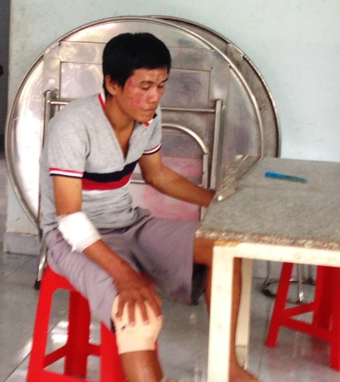 Bắt cướp bị HIV, một chiến sĩ CSGT phải điều trị phơi nhiễm