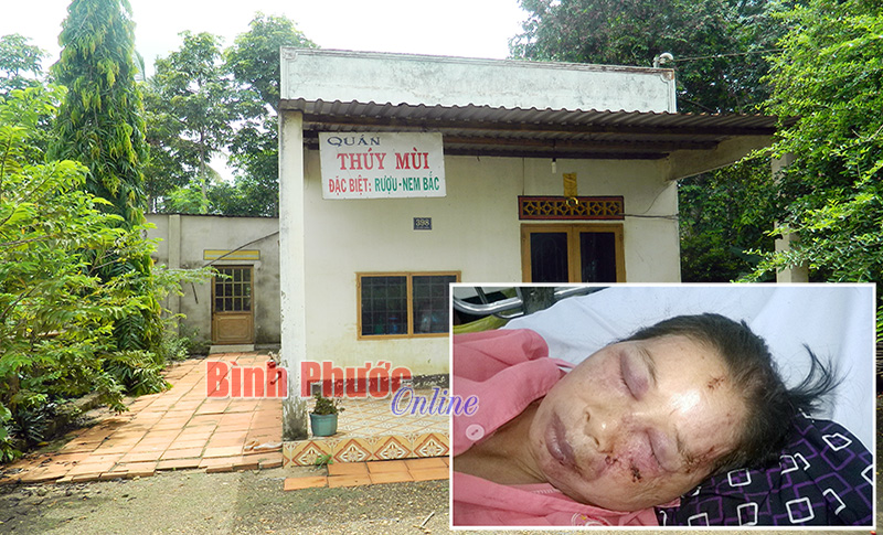 Cụ b&agrave; 61 tuổi đơn th&acirc;n bị đ&aacute;nh trọng thương