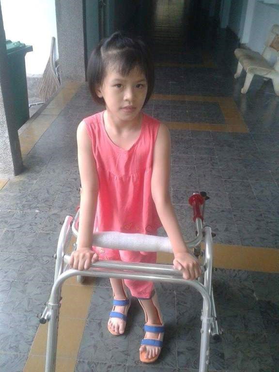 Vinmec ghép tế bào gốc chữa bại não thành công cho 1 bệnh nhân