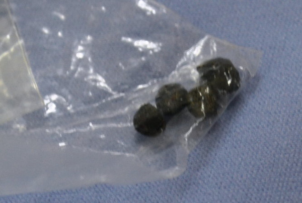 Bé trai 3 tuổi nghịch súng bắn trúng em bé 9 tháng tuổi