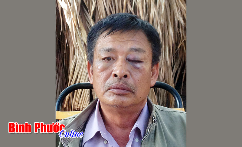 Th&ocirc;ng tin th&ecirc;m về b&agrave;i b&aacute;o: &ldquo;C&ograve;n đ&acirc;u t&ocirc;n nghi&ecirc;m chốn c&ocirc;ng đường?&rdquo;