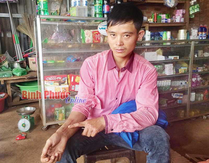 Đ&aacute;nh người trọng thương chỉ v&igrave; 25cm đất mặt đường