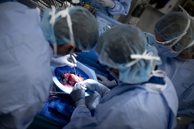 Mỹ thực hiện thành công ca ghép gan giữa 2 bệnh nhân nhiễm HIV