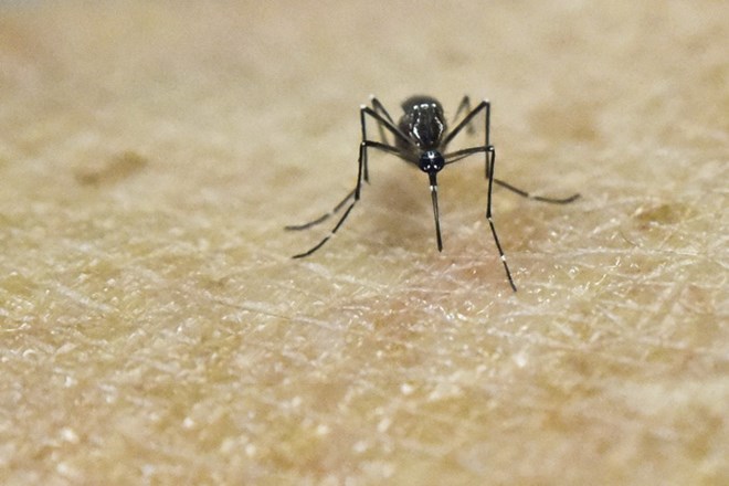 Thêm nhiều bằng chứng cho thấy virus Zika gây ra dị tật đầu nhỏ ở trẻ