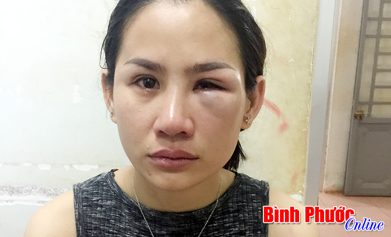 Về đ&oacute;n con, bị chồng cũ h&agrave;nh hung