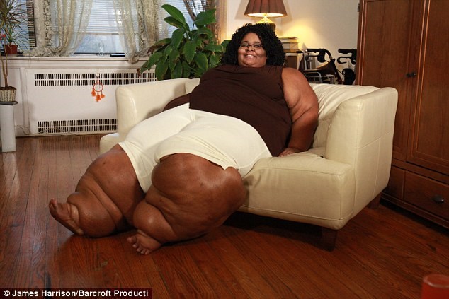 Xót thương cho số phận nghiệt ngã của người phụ nữ "chân voi"