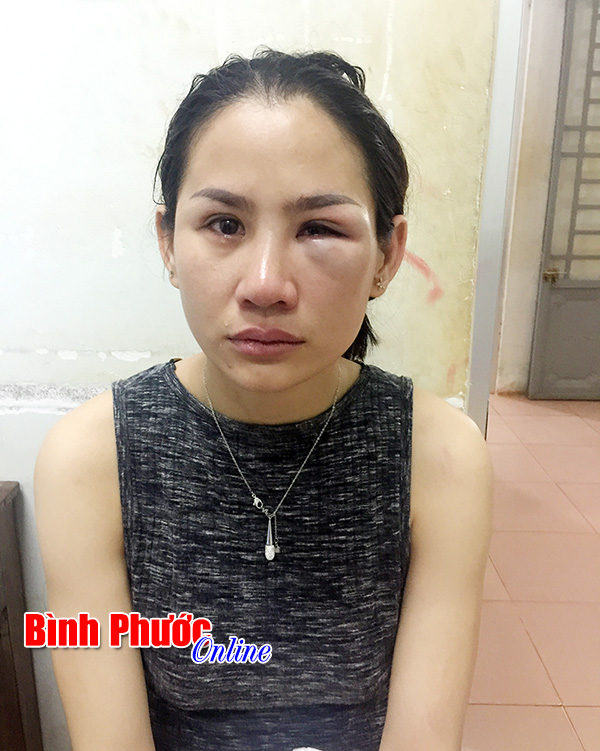 Th&ocirc;ng tin th&ecirc;m về b&agrave;i b&aacute;o: &ldquo;Về đ&oacute;n con, bị chồng cũ h&agrave;nh hung&rdquo;