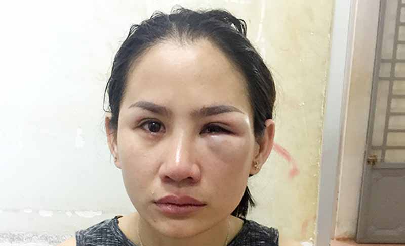 Vụ “về đón con, bị chồng cũ hành hung”: Trần Như Lai bị xử phạt hành chính