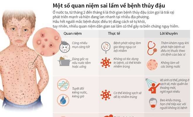 Một số quan niệm sai lầm về bệnh thủy đậu