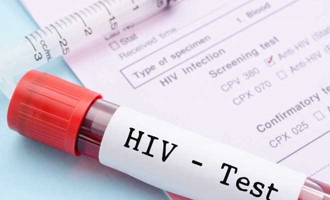 Tìm ra phương pháp xét nghiệm HIV mới cho kết quả nhanh nhất