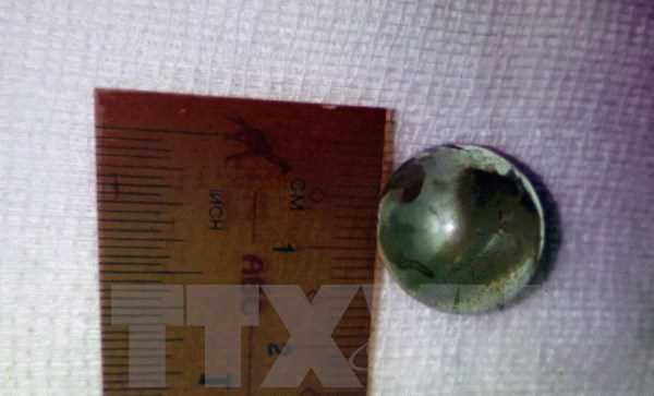 Lấy súng tự chế dọa đùa, dượng bắn đạn xuyên vào hốc mắt cháu 3 tuổi