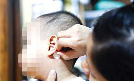 Cảnh báo miếng dán chống say tàu xe có thể gây loạn thần ở trẻ