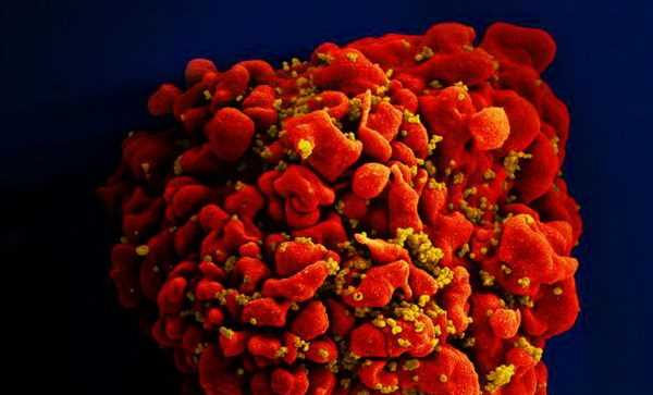 Ca nhiễm virus HIV được chữa khỏi thứ 3 trên thế giới