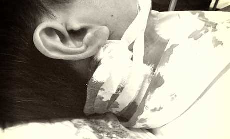 Bị tạm giữ xe, đối tượng d&ugrave;ng dao đ&acirc;m v&agrave;o g&aacute;y chiến sỹ c&ocirc;ng an