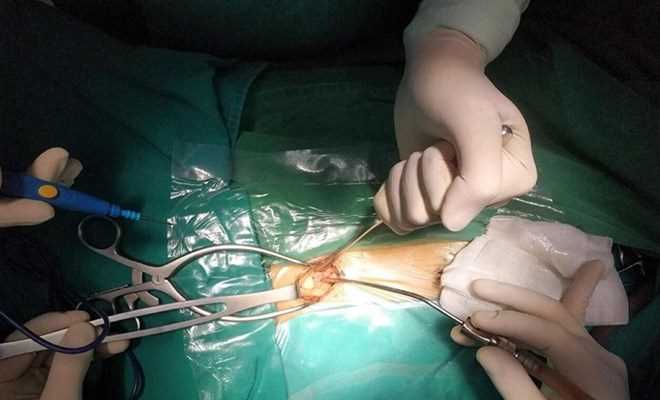 Bệnh nhi mắc bệnh Whitmore nguy hiểm bắt nguồn từ một vết ...phỏng