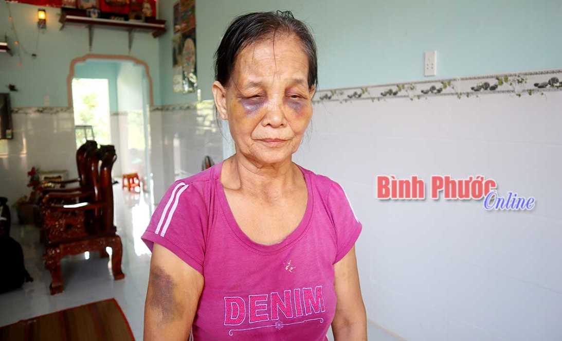 Cần làm rõ hành vi con dâu đánh mẹ chồng