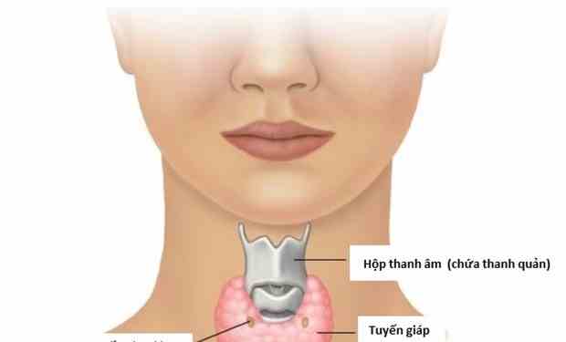 Israel đột phá trong phương pháp phát hiện ung thư tuyến giáp