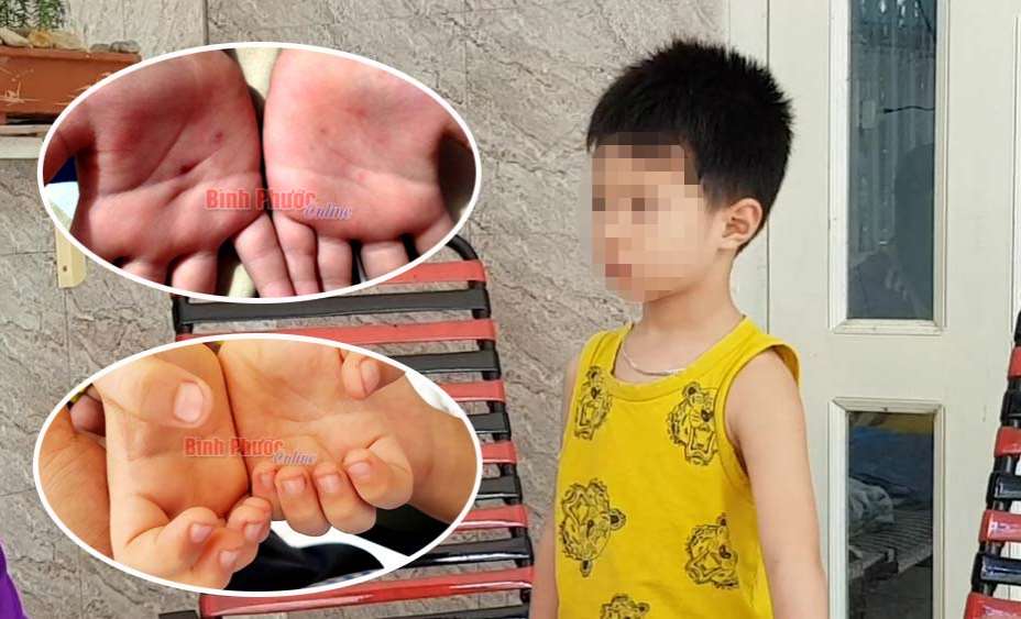 Làm rõ có hay không một cô giáo mầm non tư thục bạo hành học trò