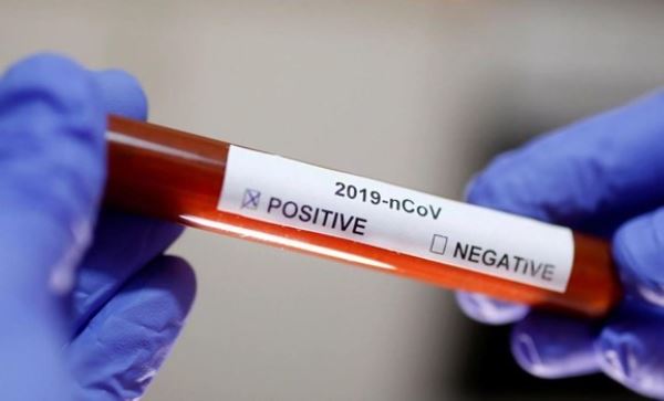 Ca mắc COVID-19 thứ 49 tiếp xúc gần bệnh nhân 30, bay chuyến VN0054