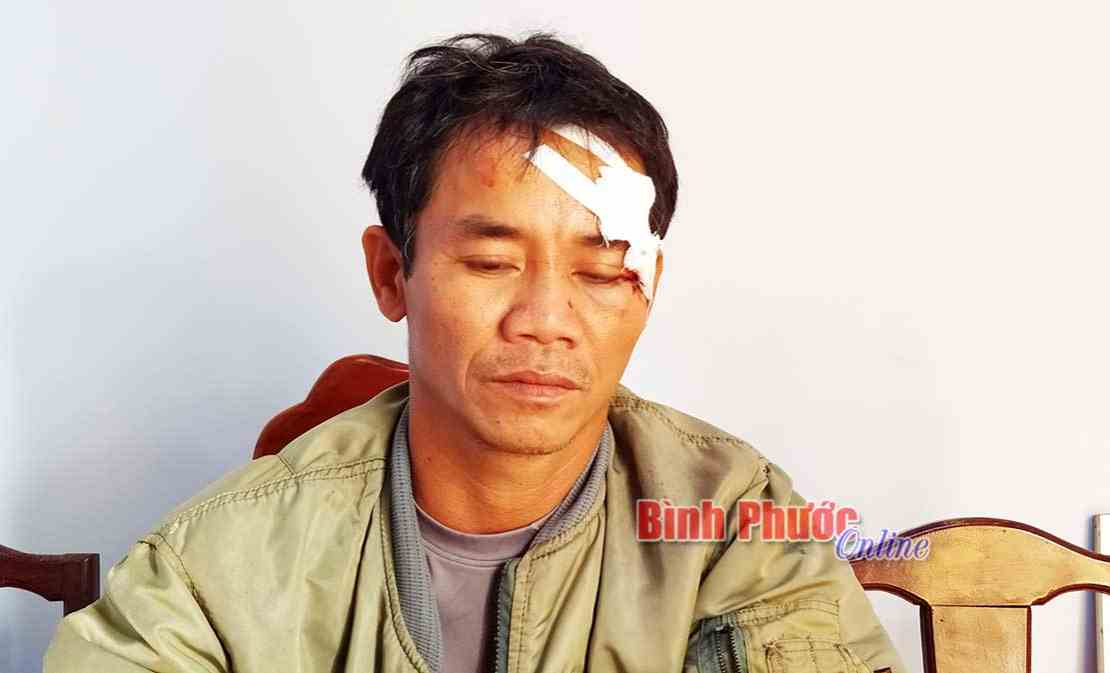 &Aacute;n mạng từ chuyện con b&ograve;