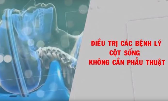 Điều trị bệnh lý cột sống không cần phẫu thuật