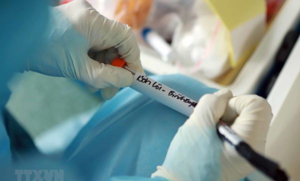 Khoảng 30 địa chỉ ở Việt Nam có thể xét nghiệm COVID-19
