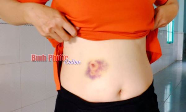 Cần xử nghi&ecirc;m những người h&agrave;nh hung thai phụ