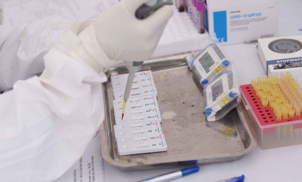 Chuyên gia phân tích khi nào cần xét nghiệm SARS-CoV-2