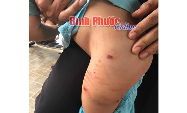 Bệnh dại ở động vật: Phòng hơn chữa bệnh