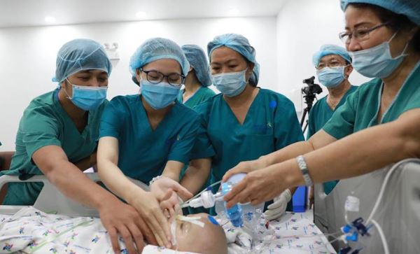 Thành công ca mổ tách hai bé song sinh dính liền